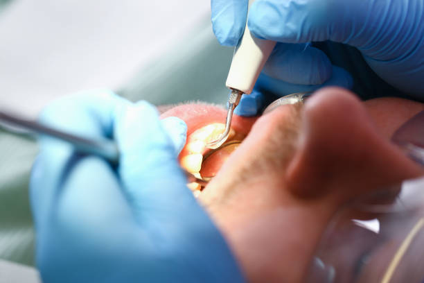 Best Dentist for Dental Trauma  in Bazon, CA