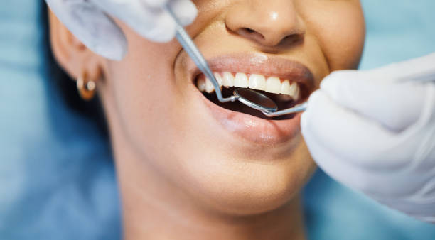 Best Root Canal Emergency Dentist  in Bazon, CA