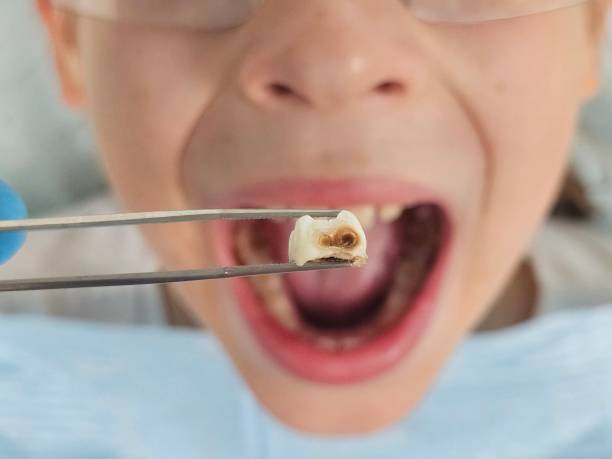 Best Tooth Pain Emergency Relief  in Bazon, CA