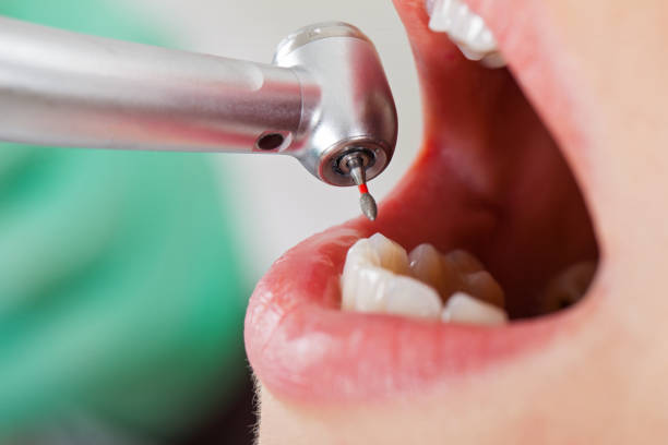 Best 24-Hour Emergency Dentist  in Bazon, CA